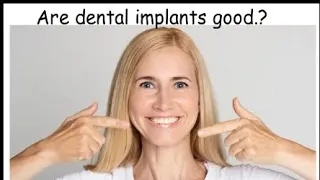Are Dental Implants GOOD.??