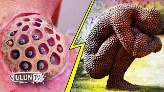 NOMOR 5 BIKIN NGILU! 5 PHOBIA PALING ANEH YANG SERING DI ALAMI MANUSIA