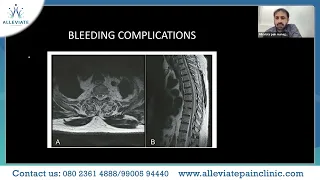 Emergencies in pain clinics | Webinar by Dr. Wiquar Ahmed