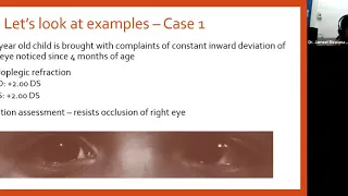 Assessment of Amblyopia - What to Look out for - Dr Rizwana.mp4