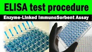 ELISA test procedure | Enzyme-Linked Immunosorbent Assay (step by step)