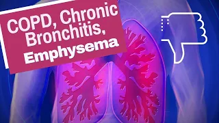 3 Little Known Secrets to Greatly Help Your COPD, Chronic Bronchitis, & Emphysema