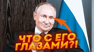 💥Проявился эффект ЛЕКАРСТВ ОТ ОНКОЛОГИИ! Это невозможно скрыть! ПЬЯНЫХ, МУРЗАГУЛОВ: УНИКАЛЬНЫЕ КАДРЫ