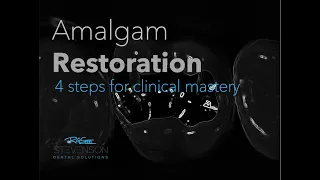 Class II Large Amalgam Restoration #14 MO Kilgore | Carving Mastery in 4 Step