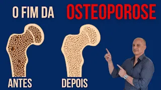 O Fim da OSTEOPOROSE || Dr. Moacir Rosa