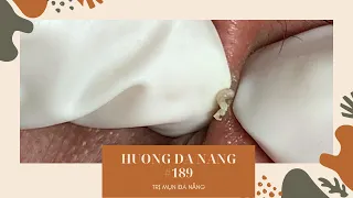 #189 | Huong Da Nang