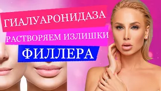 Как убрать филлер? | Гиалуронидаза | Лонгидаза