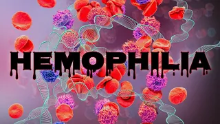 Hemophilia - CRASH! Medical Review Series