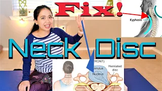 C6 C7 Herniated Disc Neck Pain and Weakness Exercises Relief