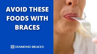 What Can I Eat the First Day Wearing Braces?