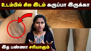 கருமை போக தினமும் இத பண்ணுங்க | Underarm Darkness | Neck Darkness | Skin care