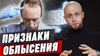 Если у вас есть эти признаки - ваша голова лысеет! / Как понять, что начинаешь лысеть?