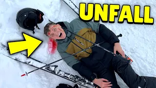 Ich hatte einen Ski Unfall...