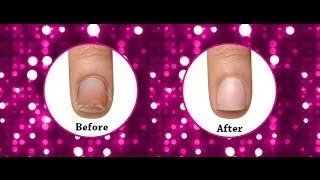 Famous Names' IBX Nail Treatment System