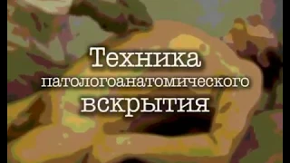 Техника патологоанатомического вскрытия.avi