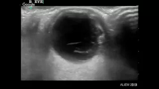 Ocular: Trauma & Swelling (2/5)