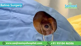 Live Retina Surgical Demonstration || Sanjivani Eye Hospital ||