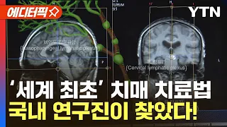 [에디터픽] '치매 치료' 새로운 문 열렸다…뇌 노폐물 배출 경로 발견 / YTN