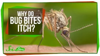 Why Do Bug Bites Itch?