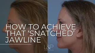 How To Achieve That Snatched Jawline | Palo Alto, CA