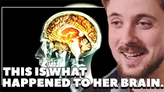 Forsen Reacts To: "A Woman Drank "35% Food Grade Hydrogen Peroxide." This Is What Happened"