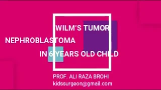 WILM'S TUMOR EXCISION ,NEPHROBLASTOMA   PROF.  ARB