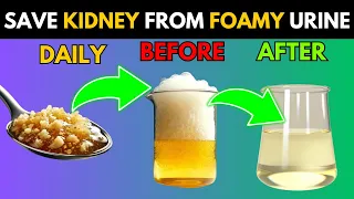 These 10 SuperFoods to stop Proteinuria quickly and Heal Kidney Fast