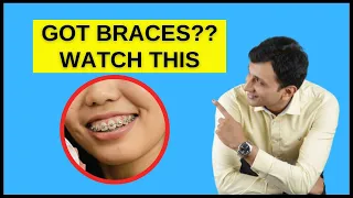 TIPS for BRACES Wear | Orthodontic Home Care Instructions | How Care For Braces |Brushing & Flossing