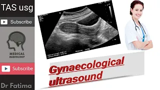 Female transabdominal Pelvic Ultrasound by dr.fatima