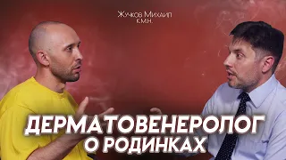 ДЕРМАТОЛОГ. Солярий, меланома, опасные родинки и крема для загара