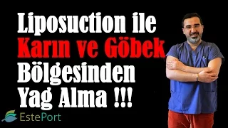 Liposuction ile Karın ve Göbek Bölgesinden Yağ Alma