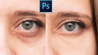 How to Remove Dark Circles Naturally in Photoshop | 1-Minute Tutorial