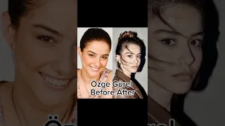 Özge Gürel Before After #özgegürel #beforeafter #shorts #shortsyoutube #озгегюрель #turkishactress