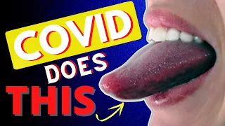 7 WEIRD SYMPTOMS OF COVID
