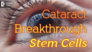 Can stem cells repair Cataract in eyes? - Dr. Sunita Rana Agarwal