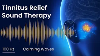 Tinnitus Sound Therapy - 100 Hz Calming Waves | 2 Hours | Sound Masking for Ringing in Ears