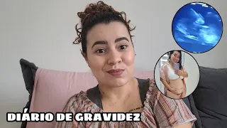 DIÁRIO DE GRAVIDEZ || SINTOMAS, PRIMEIRA ULTRASSOM, MORFOLÓGICA DO PRIMEIRO TRIMESTRE 👶🏼💗