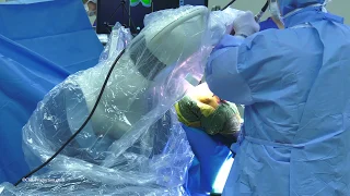 Robotic Total Knee Replacement - Plymouth Bay Orthopedic Associates, Inc.