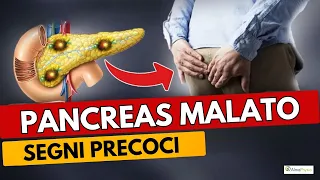 TUMORE AL PANCREAS: i segni PRECOCI di un problema SERIO