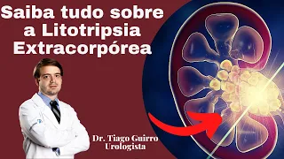 Saiba tudo sobre a Litotripsia Extracorpórea