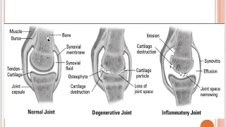 Introduction to Rheumatology