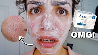 I USED DOVE SOAP ON MY FACE!