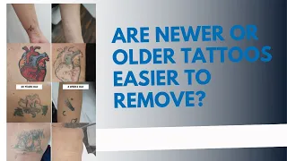 Are Newer Or Older Tattoos Easier To Remove?