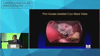 CVI2018 Session:  Surgical-like results with transcatheter therapy - Gorav Ailawadi, MD