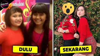 DULU SERING DICAP JELEK! Sekarang Lihat Sendiri Perubahan Fisik Artis Indonesia ini yang Bikin Kaget