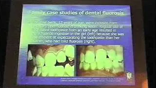 Dryden, Ontario Fluoride Presentations 2008