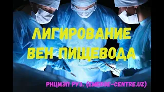 Лигирование варикозно расширенных вен пищевода при пищеводном кровотечении. Учебный материал РНЦЭМП.