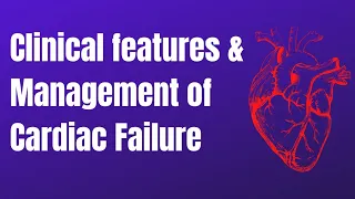 Clinical Features and Management of Cardiac Failure