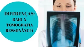 Descubra a diferença entre Raio-X , Tomografia e Ressonância Magnética! Vou te contar agora!