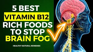 5 Best Vitamin B12-Rich Foods To Stop Brain Fog